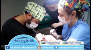 ‫افضل زراعة للشعر بمركز Hairestetik Turkey زراعة الشعر في تركيا‬‎ 