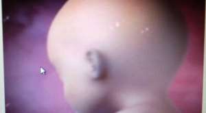 Hamilelik belirtileri sesli ve görsel sunumu ve resimlerle anlatımı
