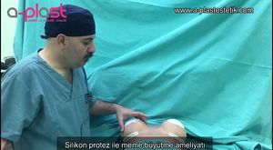 MEME BÜYÜTME (GÖĞÜS) SİLİKON ESTETİĞİ AMELİYATI | OP DR GÖKHAN ÖZERDEM ANTALYA ESTETİK CERRAH