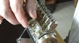 Kadının Saçlarında Çıkan Binlerce Bit