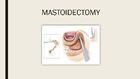 Mastoidectomy - Meddco