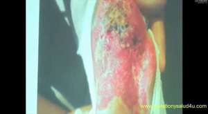 Historias jamas antes vistas de Éxito Immunotec México 