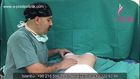 KOLTUK ALTINDAN SİLİKON İLE MEME (GÖĞÜS) BÜYÜTME AMELİYATI İZLE | OP DR GÖKHAN ÖZERDEM ESTETİK PLASTİK CERRAH ANTALYA
