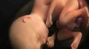 Hamileliğin 1 ayında anne karnındaki bebek ne durumdadır