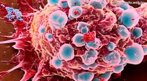 Kanser genetik bir miras mıdır?