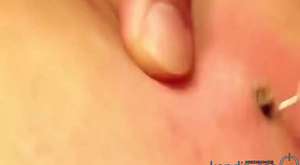 5 Worst Ear Bugs Ever! (Popping & Removal) 