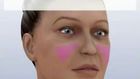 Yüz Estetiği ve Estetik Yüz Germe Ameliyatı Videosu