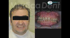 Before / After - Medicadent Dental Clinic