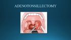 ADENOTONSILLECTOMY - MEDDCO video