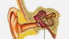 Orta Kulak Kireçlenmesi (Otoskleroz Hastalığı) Animasyonu 