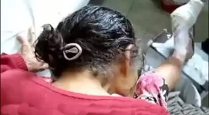 Kadının Saçlarında Çıkan Binlerce Bit