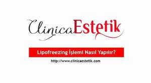 Dövme silme işlemi nasıl yapılır ?