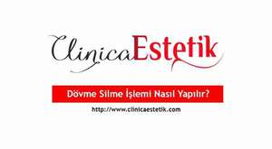 Dövme silme işlemi nasıl yapılır ?