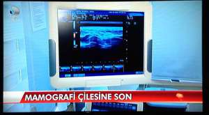 Dr Cem Yılmaz SOFIA TomoSonografi sistemini anlatıyor Kanal24 01.04.14