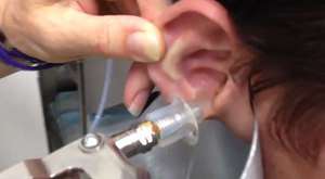 Roadside Ear wax cleaner : Painful way to remove dirt and gunk with a needle ??