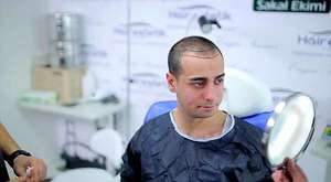 Hair Transplantation Center Hairestetik Turkey 