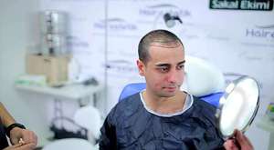 ‫افضل زراعة للشعر بمركز Hairestetik Turkey زراعة الشعر في تركيا‬‎ 