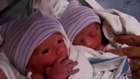 15 dakikalık ikiz bebekler