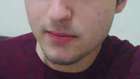 Roaccutane Yan Etkileri ve Kullanımı - 3.Ay