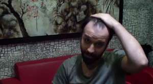 Saç protezi hakkında Hairlife'ın yeni videosu
