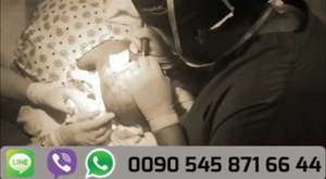 ‫افضل زراعة للشعر بمركز Hairestetik Turkey زراعة الشعر في تركيا‬‎ 